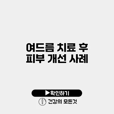 여드름 치료 후 피부 개선 사례